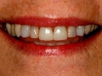 Konig Center for Cosmetic & Comprehensive Dentistry smile photos